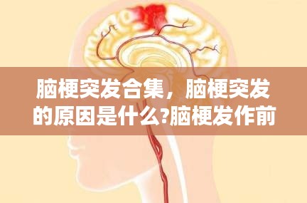 脑梗突发合集,脑梗突发的原因是什么?脑梗发作前