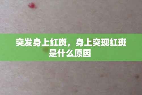 突发身上红斑,身上突现红斑是什么原因